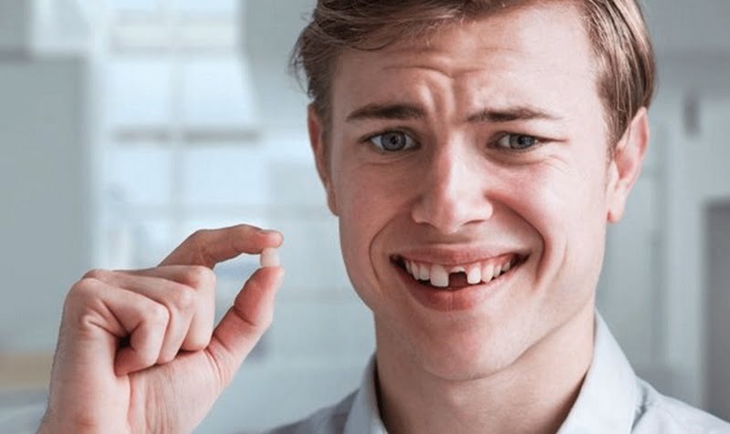 Luận giải mơ thấy rụng răng đánh con gì Luận giải mơ thấy rụng răng đánh con gì