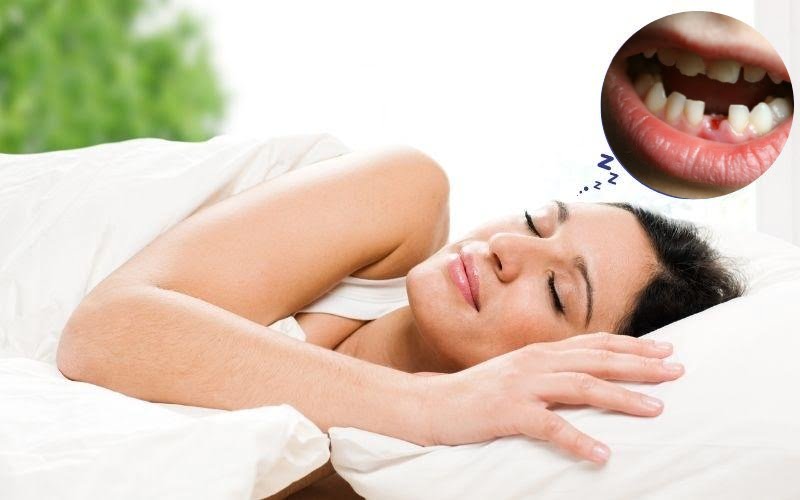 Mộng thấy rụng 3 chiếc răng nên đánh số 37 dự thưởng Mộng thấy rụng 3 chiếc răng nên đánh số 37 dự thưởng